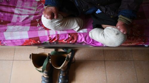 La lebbra: una malattia che ancora crea emarginazione