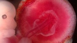 Feto_placenta_.jpg