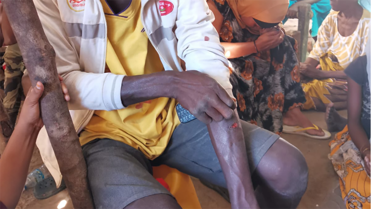 Flüchtlinge in Pemba