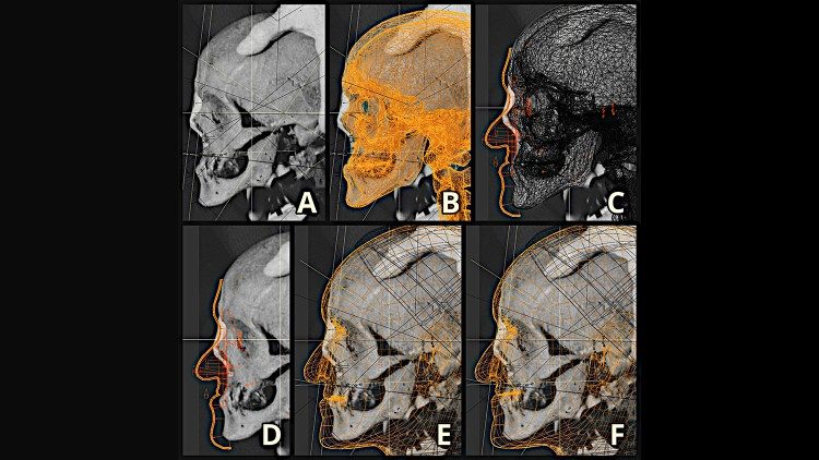 O trabalho digital nas imagens do crânio de São Vicente