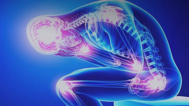 Fibromialgia, una malattia che interessa l'apparato muscolare e scheletrico
