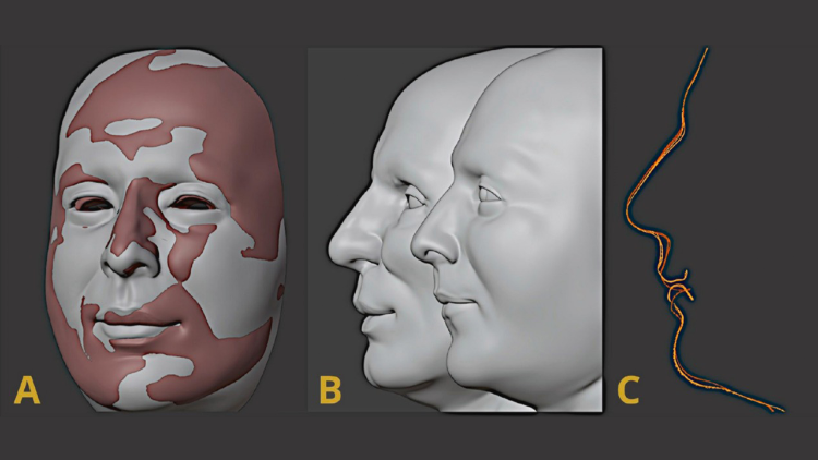 Reconstru&ccedil;&atilde;o do cr&atilde;nio: Direitos autorais concedidos pelo autor.