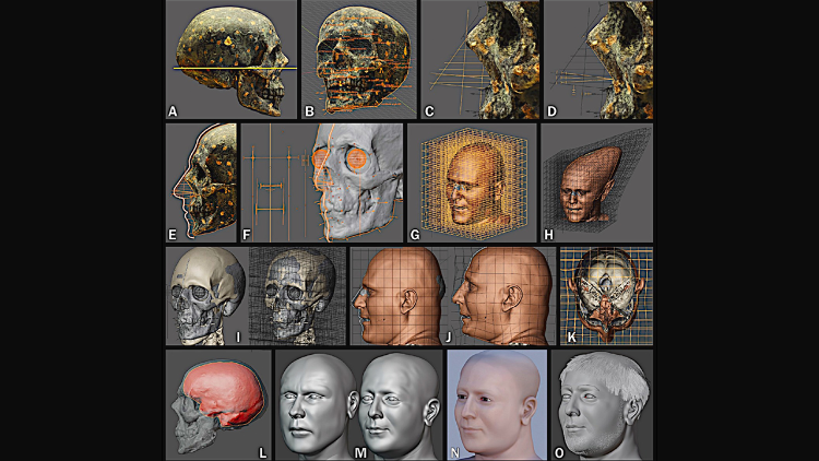 Reconstru&ccedil;&atilde;o do cr&atilde;nio: Direitos autorais concedidos pelo autor.