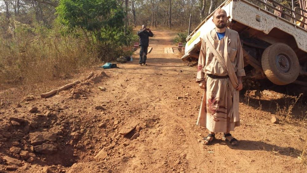 Il sangue del piede dilaniato dalle mine